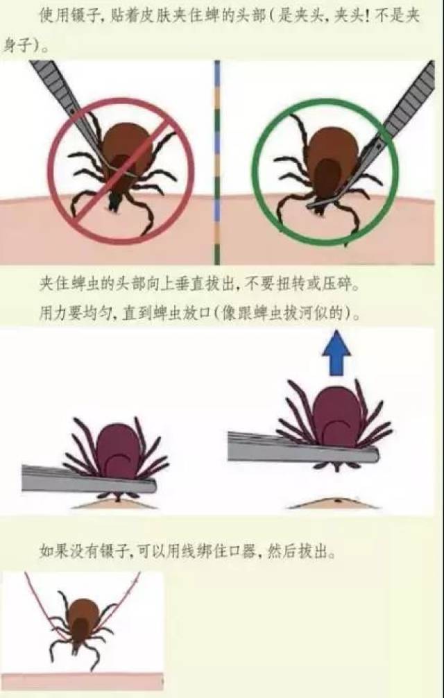 狗狗是怎么把蜱虫带回家的?看完惊呆了