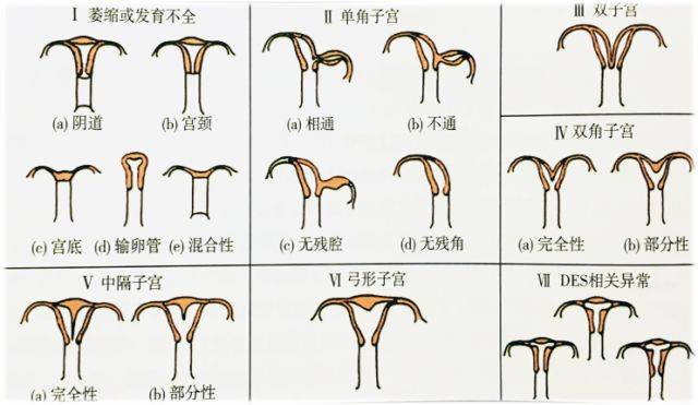 均匀,光滑;卵巢周围环状强回声带,子宫直肠窝及肠间隙微气泡弥散均匀