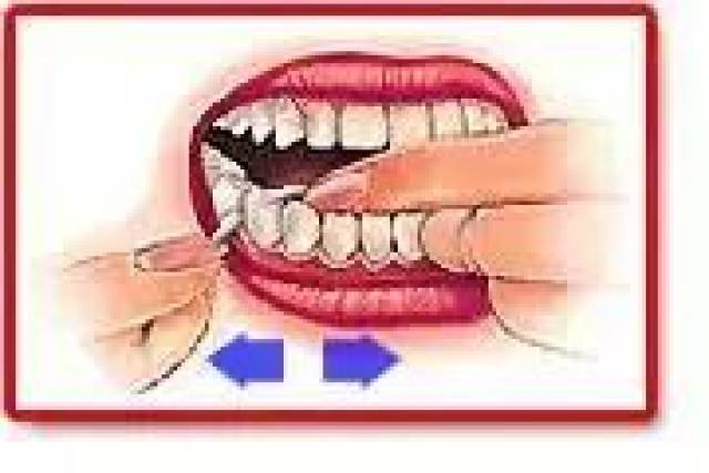 把牙线放在两颗牙齿之间的牙缝,向牙龈方向轻柔地施加压力,左右拉动