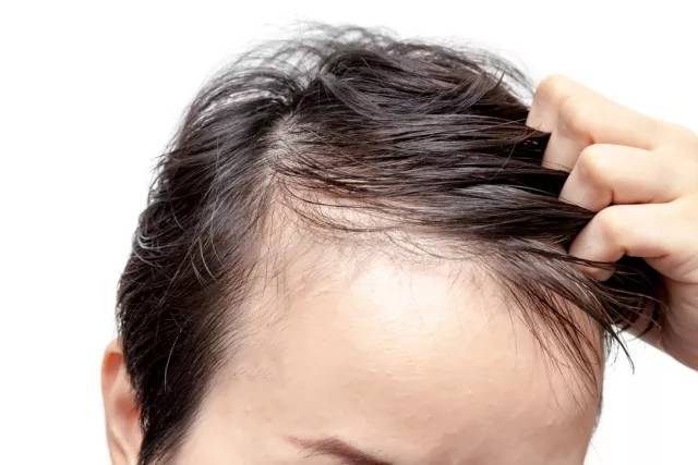 少白头,头发稀疏,脱发?从头发看出身体密码!