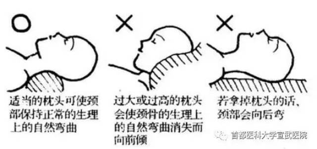 宣医科普|睡觉姿势不对,小心颈椎病找上门