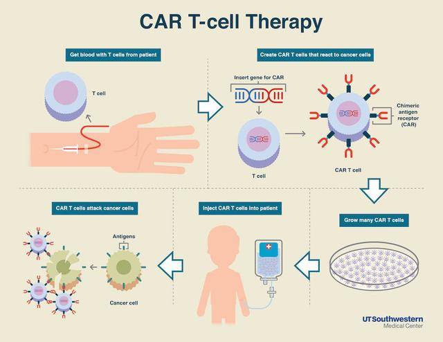 car-t疗法发挥抗癌作用最小剂量为1个细胞