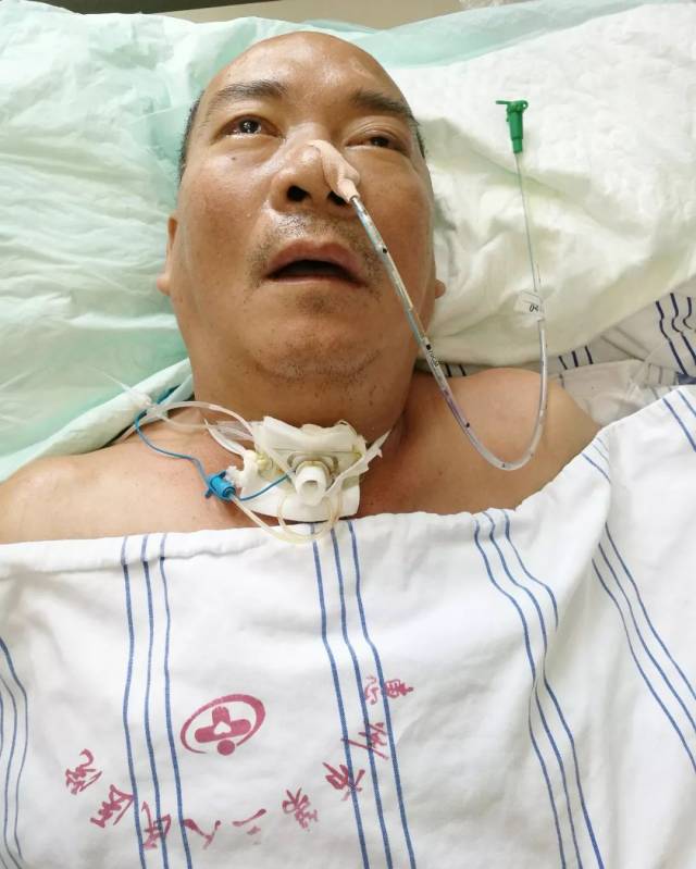【科室风采】惠州三院微创技术精准治疗脑干出血,患者昏迷半月后奇迹