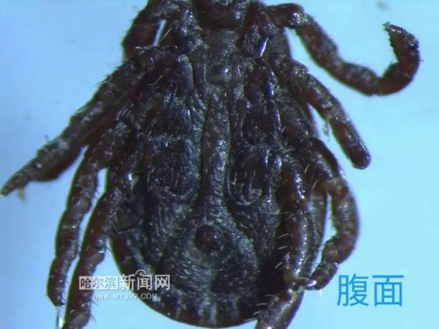 这么多蜱虫, 随便一只钻进皮肤里都够呛