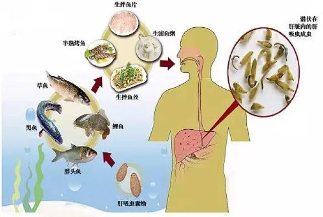 误区1:酱油,芥末等调味料能杀死肝吸虫?