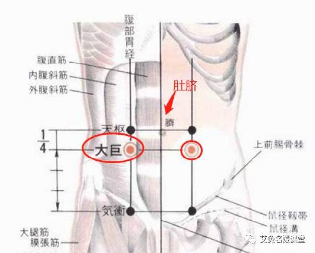 附件炎盆腔积液,也