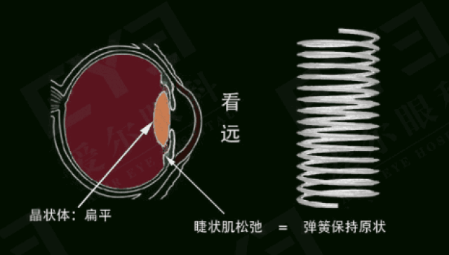 看图写话四幅图近视眼