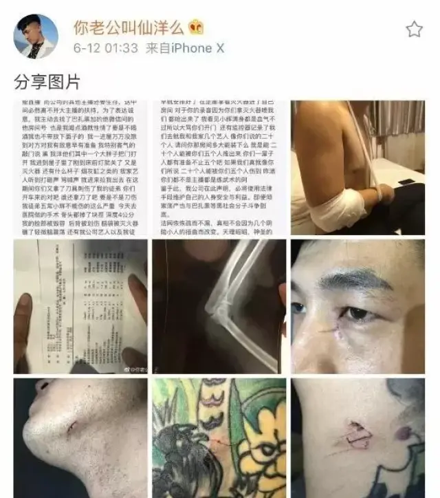 接上条 在巴扎黑与王某人讲诉完打架过程之后,今日凌晨仙洋也在微博发