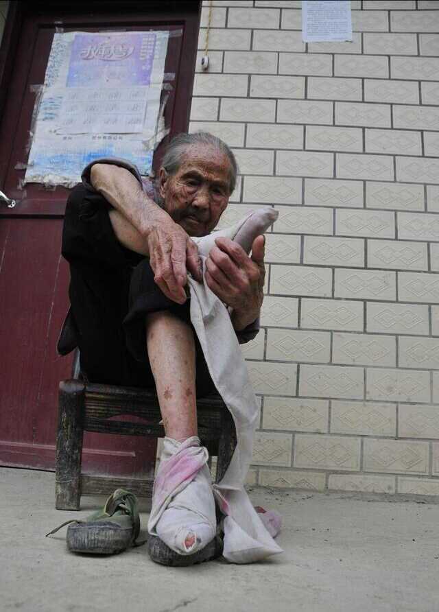 贵州省黔东南岑巩县一老人深受缠足影响,让人看着很心疼!