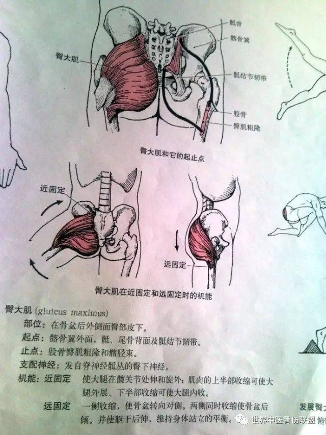 髋关节及相关肌群功能障碍的肌动学评定和干预