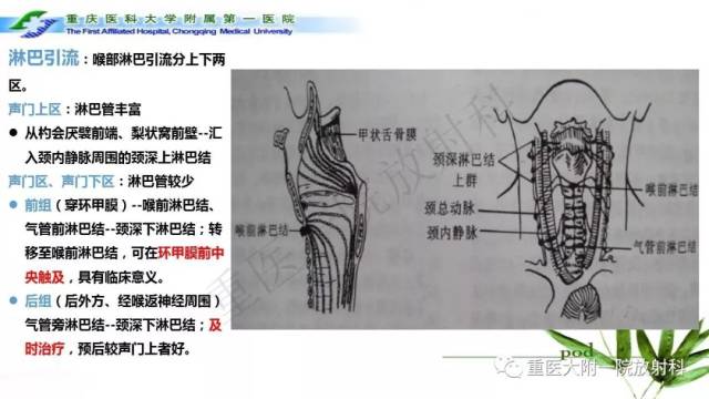 喉部解剖及t分期影像诊断