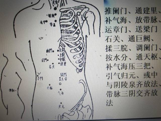 用右手拇指按住阑门穴,旋转推按;左手大指迎住巨阙部位.