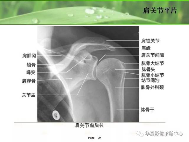 肩关节解剖及常见病变的mri诊断