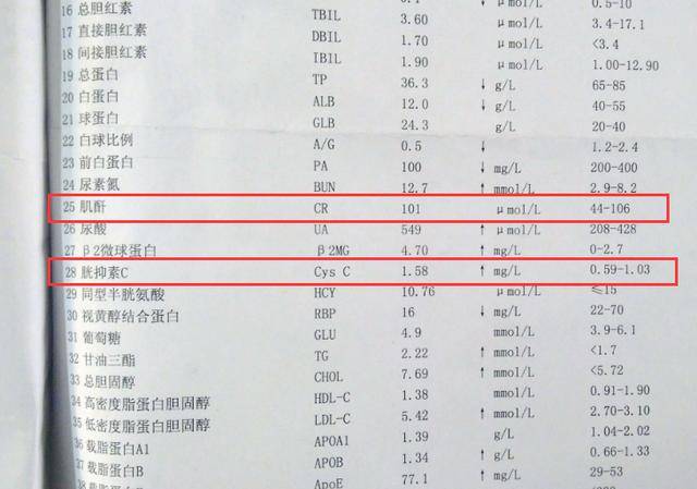 血肌酐生性"迟钝",肾病患者别被这个指标坑了