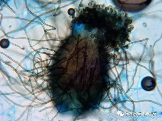 10种水中常见细菌在显微镜下的照片,你见过吗?