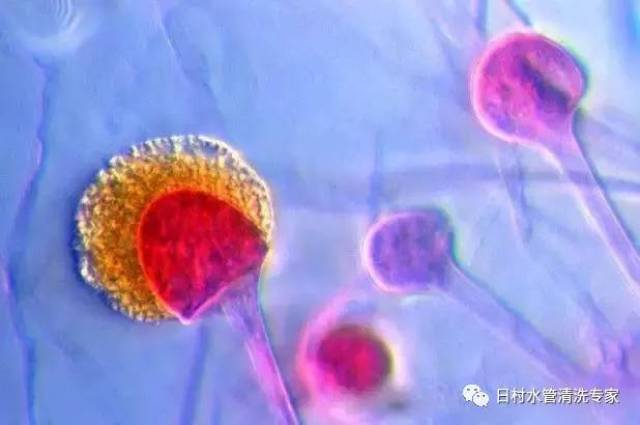 10种水中常见细菌在显微镜下的照片,你见过吗