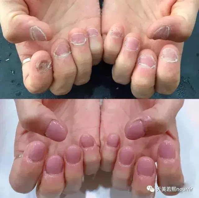 别再说我们做美甲浪费钱!做美甲前后对比,堪比整容!