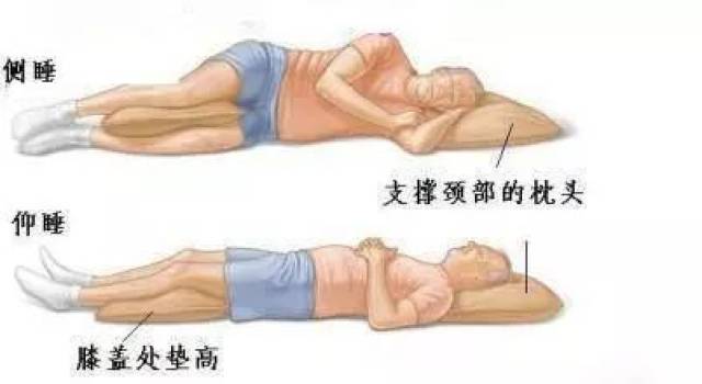腰间盘突出,如何正确锻炼?好好收藏吧!