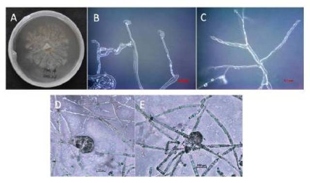 菌落特征和显微镜下菌丝和孢子囊结构特征