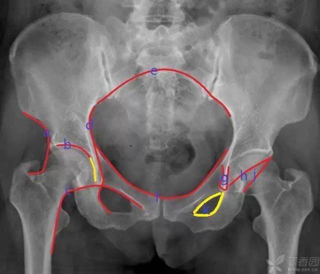据说只有 1% 骨科医生能完全读懂骨盆 x 线片,不信你来试试