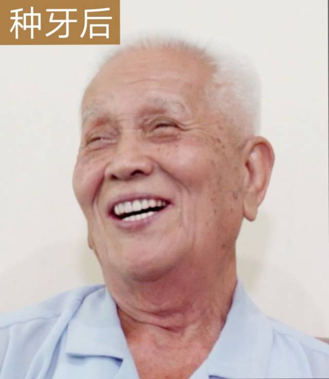 90岁老人竟然"长"了全口新牙?