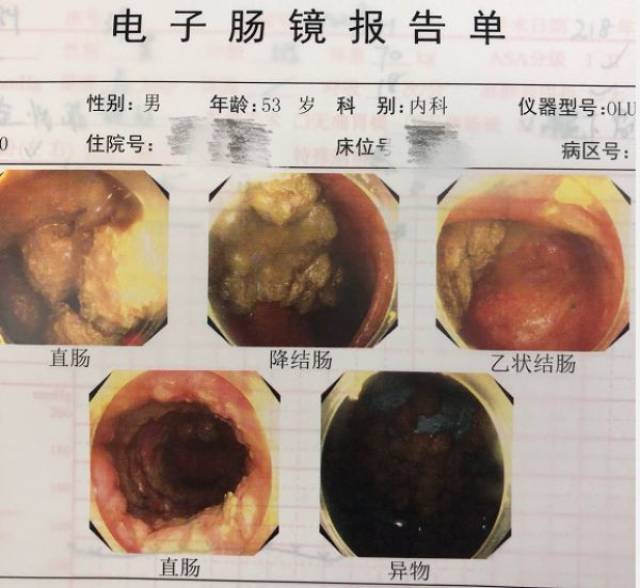 杨梅到底吐不吐核?有人吃成肠梗阻,宁波人都快吵翻了!