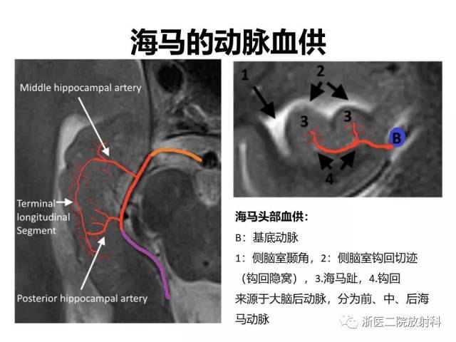 文献学习 | 海马正常解剖及病变介绍