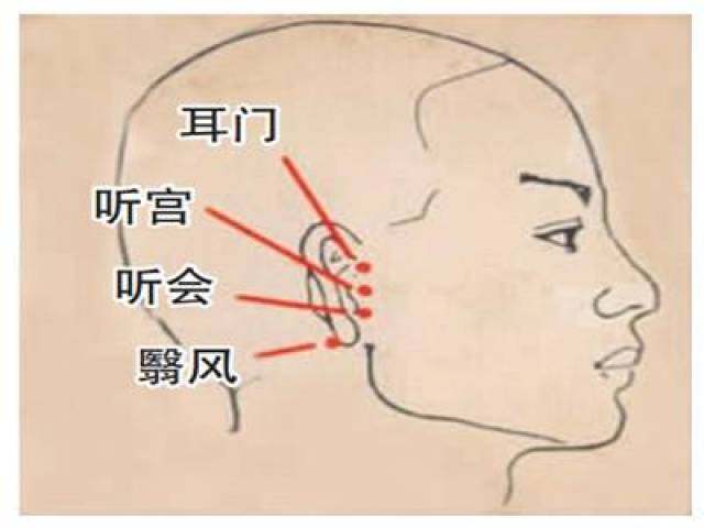 耳门穴位置图和作用