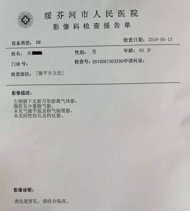 【绥芬河市人民医院】我院普外科完成我市首例腹腔镜下胃穿孔修补手术