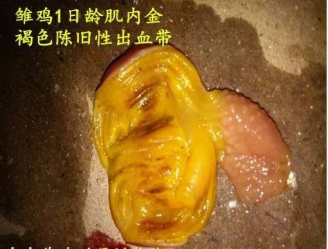 再次回顾---腺肌胃炎