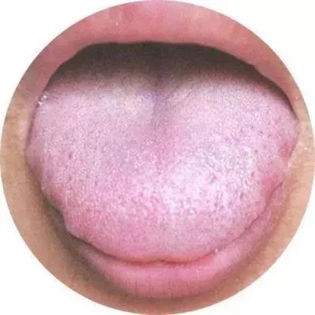 舌淡胖,且苔白 治法:健脾补气 方药:适宜使用人参,黄芪,白术,炙甘草