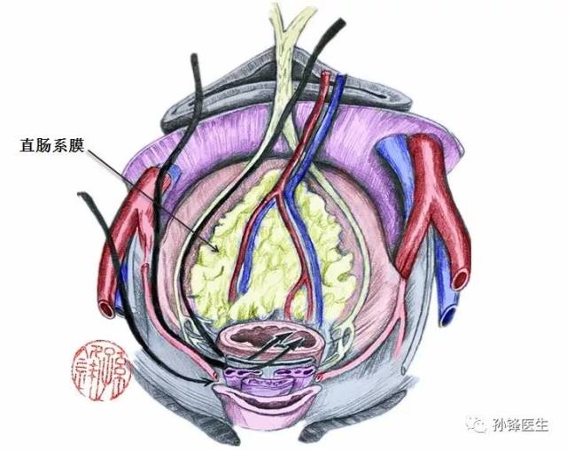 医学笔记|立体理解直肠癌根治手术的三个层面(附:彩色图谱)