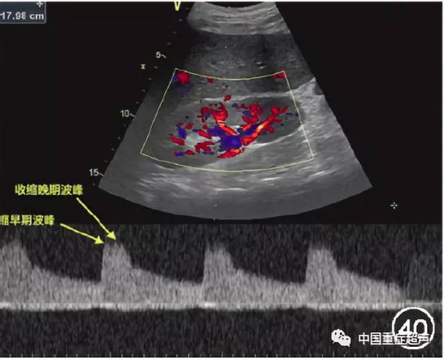 重症超声临床应用技术规范-胃肠 肾脏