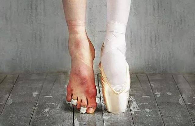 芭蕾舞者的脚
