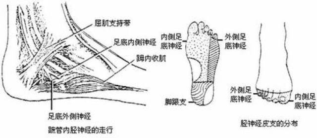 为减轻胫神经上的张力,尤其是对于扁平外翻足的患者,可用支具限制旋