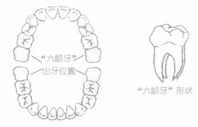 "六龄牙"在儿童口腔中的位置和形状