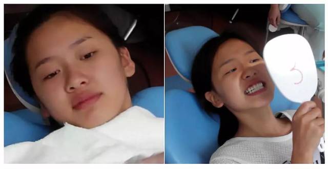 矫正牙齿被看重,死对头问我多少钱说不说