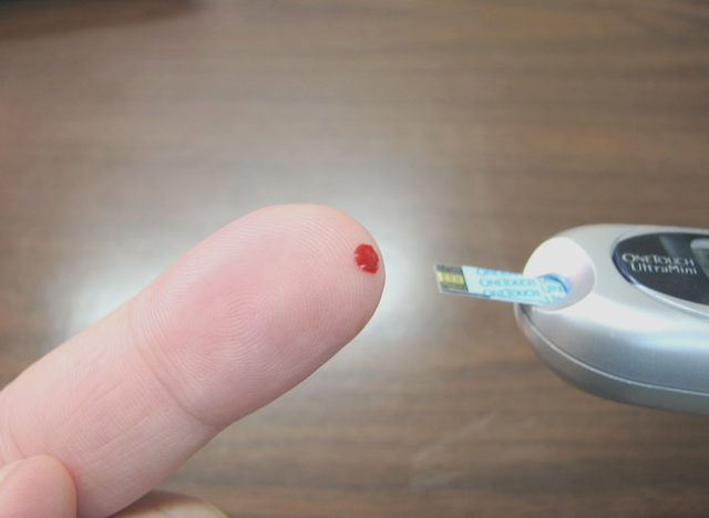 家用血糖仪扎手指疼吗,在家如何正确测血糖?