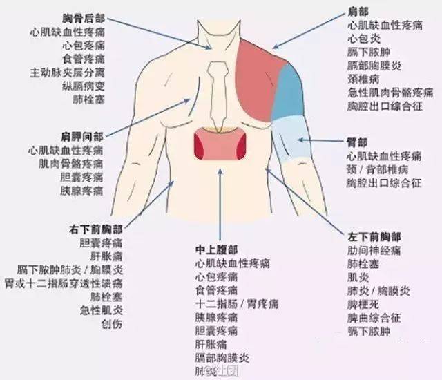 20张图,让你秒懂心血管疾病