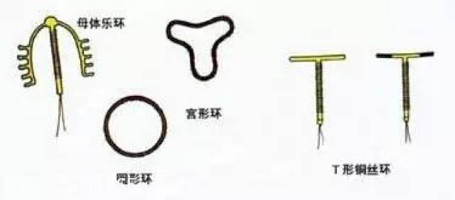 避孕环是放置在宫腔内的一种宫内节育器,从形状上分环形,t形,v形等多