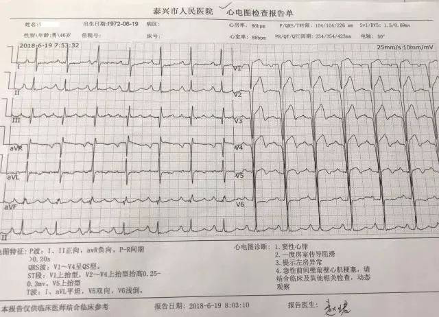 首份心电图检查提示其"急性广泛前壁心肌梗死";抽血查心梗指标三项也