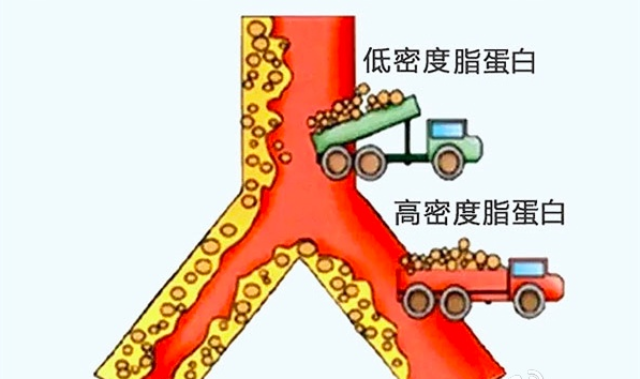 抗动脉硬化英雄——高密度脂蛋白 hdl