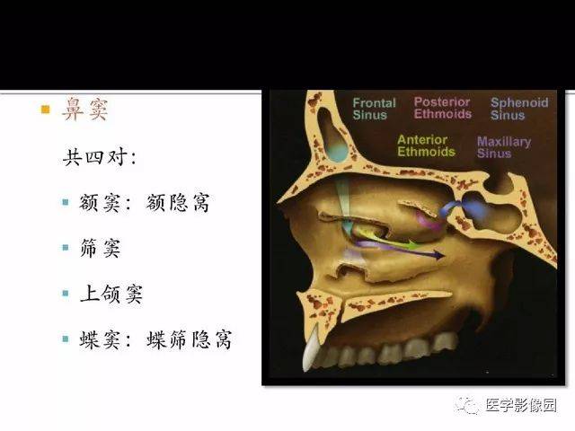 别再说难了,手把手教您学鼻腔鼻窦及颅底ct影像解剖