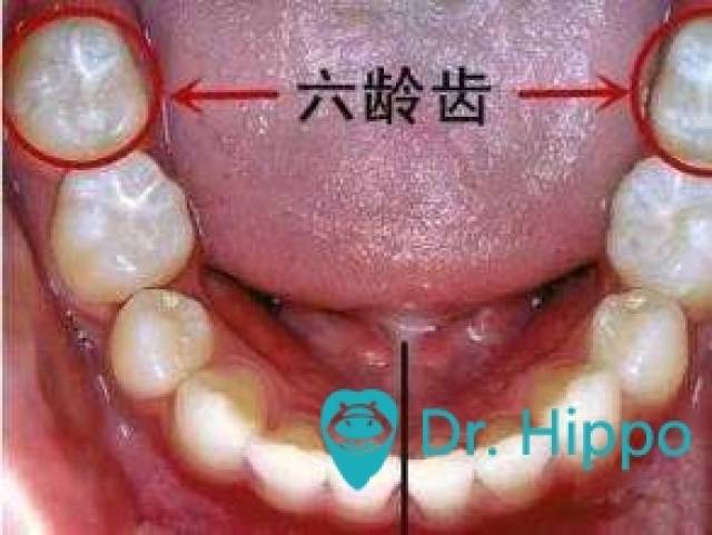 六龄牙是哪一颗牙齿?