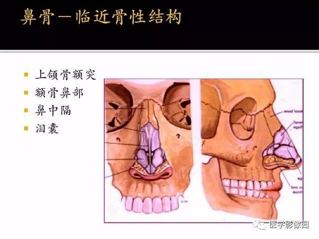 别再说难了,手把手教您学鼻腔鼻窦及颅底ct影像解剖