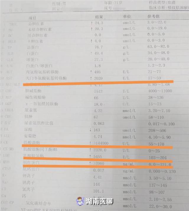 并且,王同学 丙氨酸氨基转移酶和天门冬氨酸氨基转移酶都高于正常值!