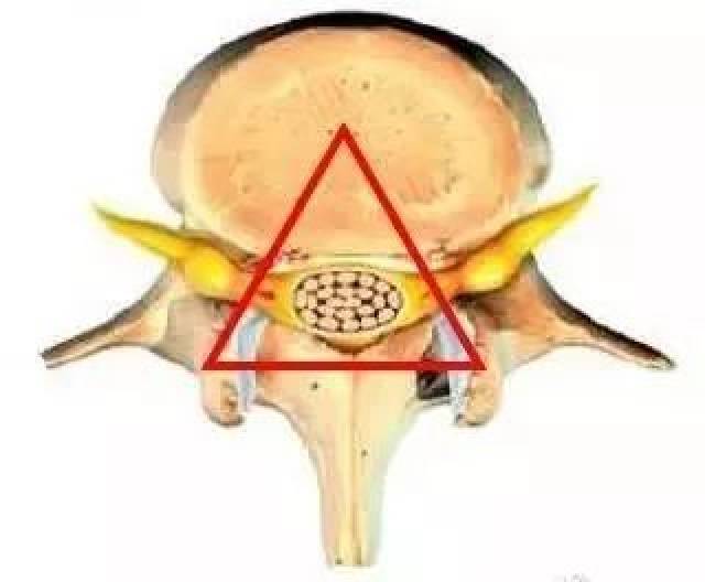 腰椎小关节紊乱 腰椎小关节,又称为关节突关节,是位于腰椎椎节之间