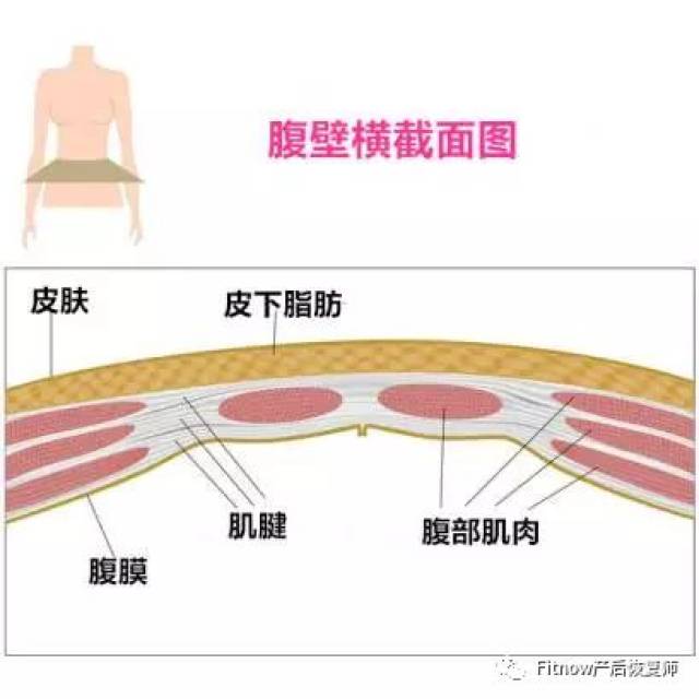 腹直肌分离了解一下!