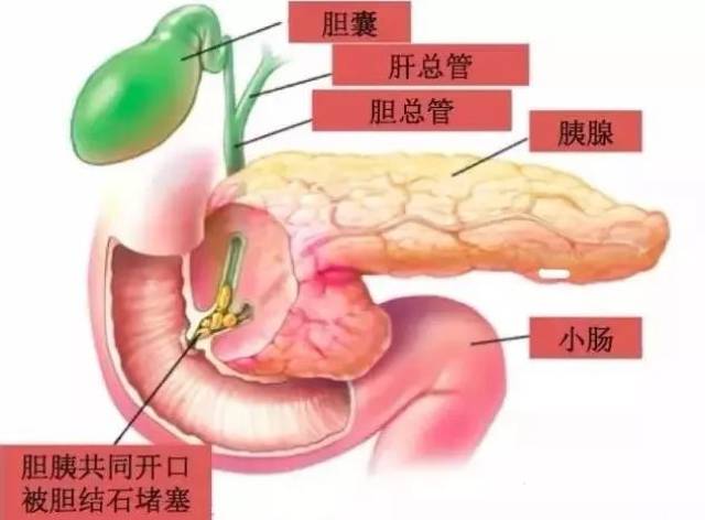 胆结石的腹痛有什么表现特点?