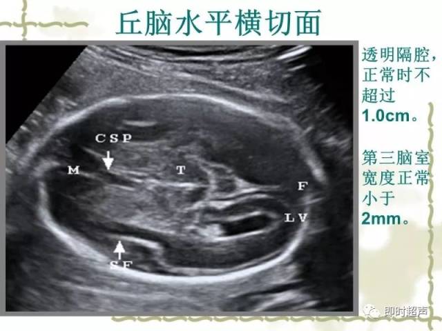 中孕期胎儿超声检查规范切面